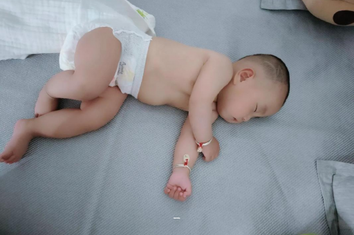 龙海宝宝脸上有白色斑块
